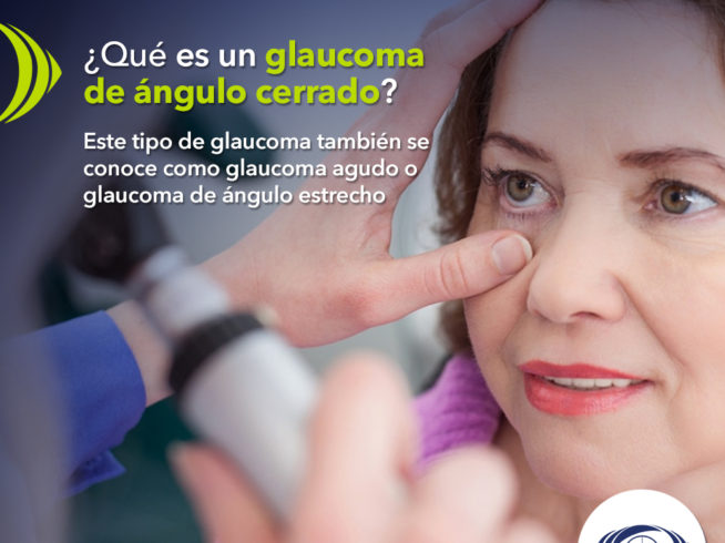 ¿Qué es un glaucoma de ángulo cerrado?
