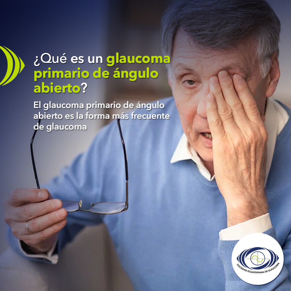 ¿Qué es el glaucoma primario de ángulo abierto?