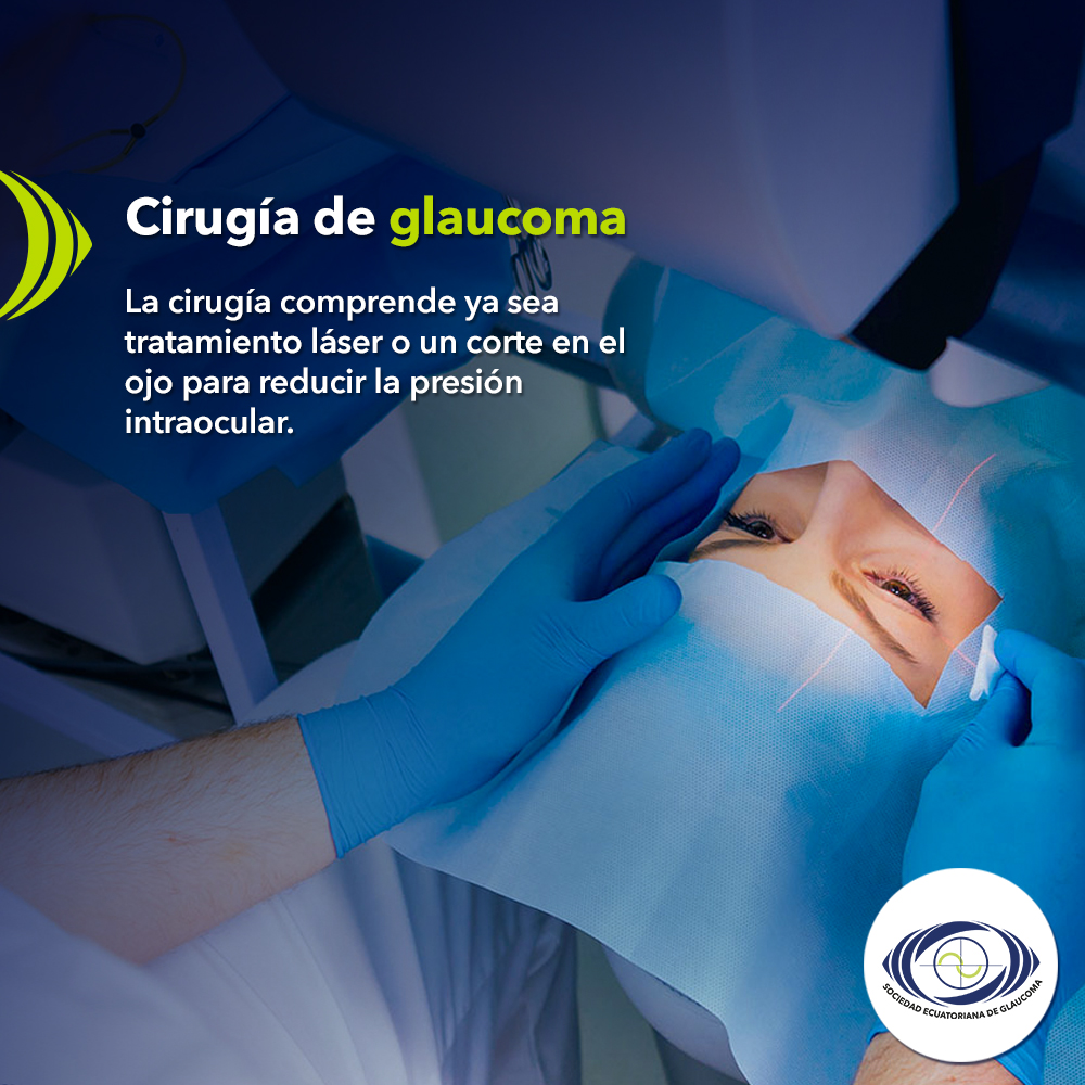 Cirugía de glaucoma