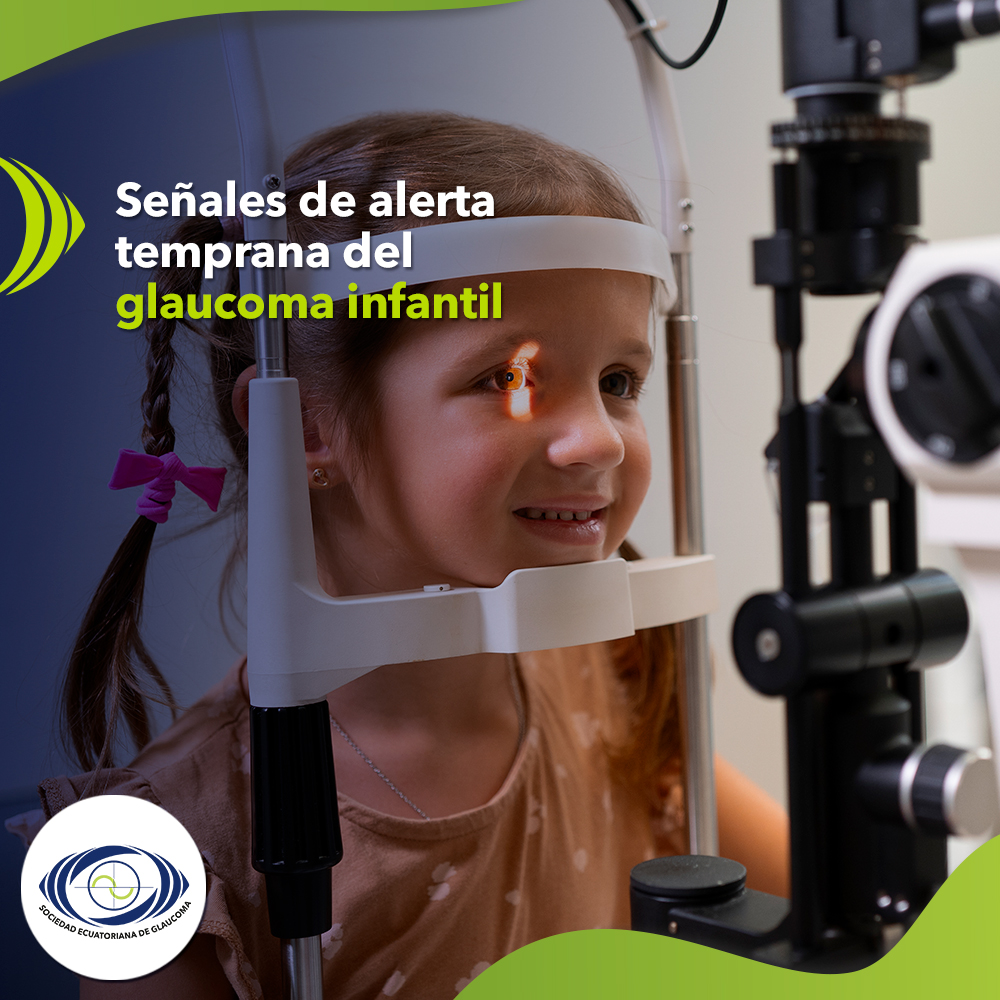 Señales de alerta temprana del glaucoma infantil