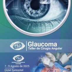 Taller Cirugía Angular en Glaucoma | Sociedad Ecuatoriana de Glaucoma